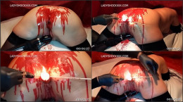 Candle Anal & Wax