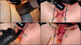 Fisting, Anal,Dilation, Pee